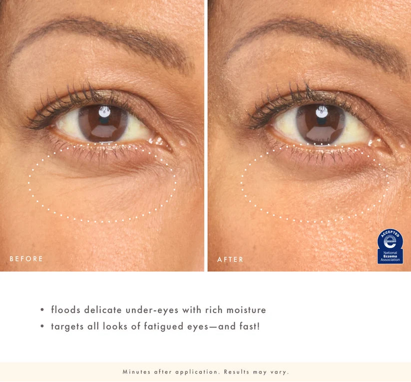 Eye'm Revived™ Total Renewal Cream