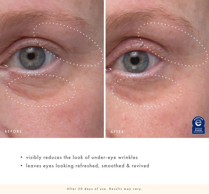 Eye'm Revived™ Total Renewal Cream